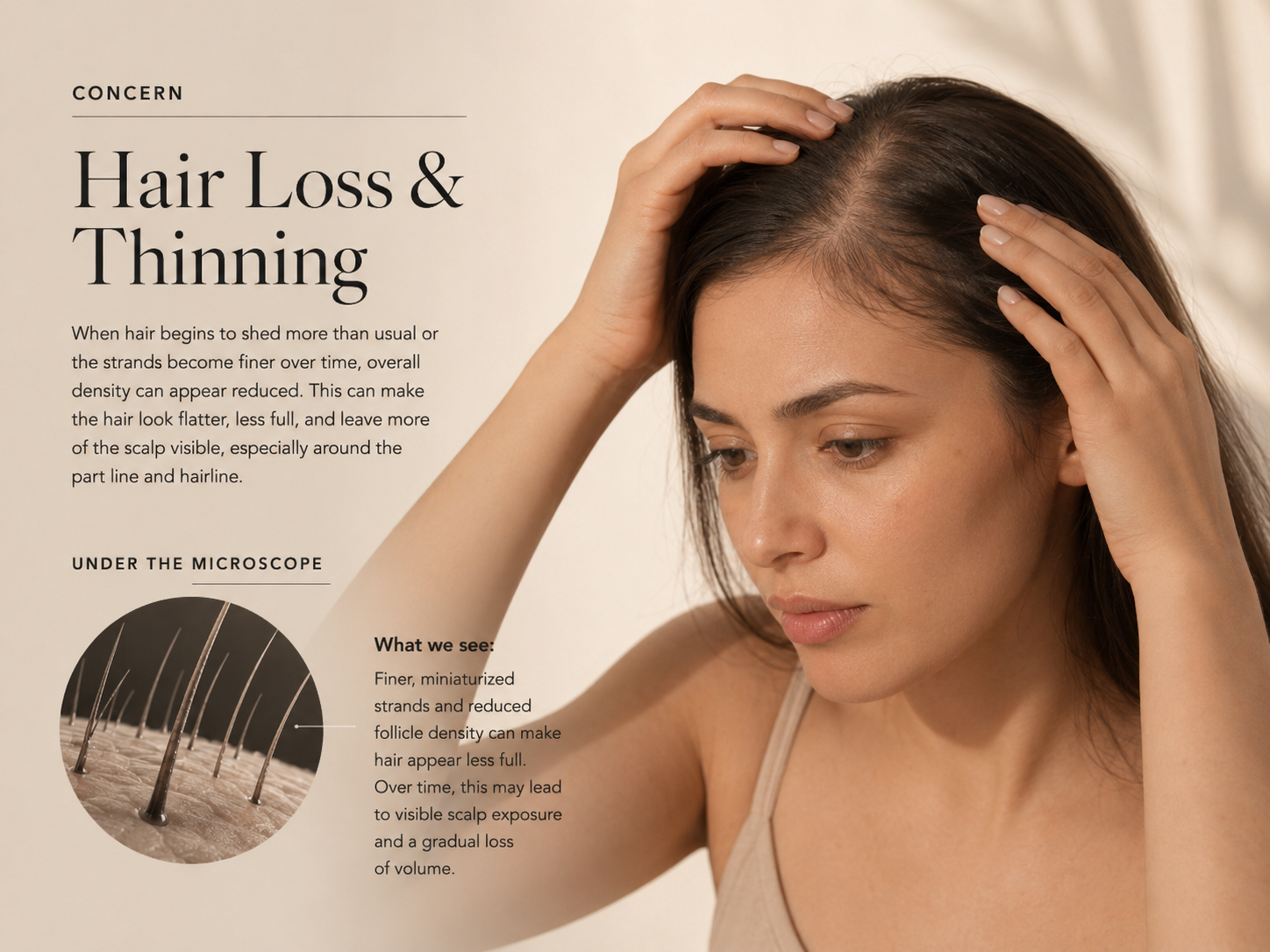 Hair Loss & Thinning