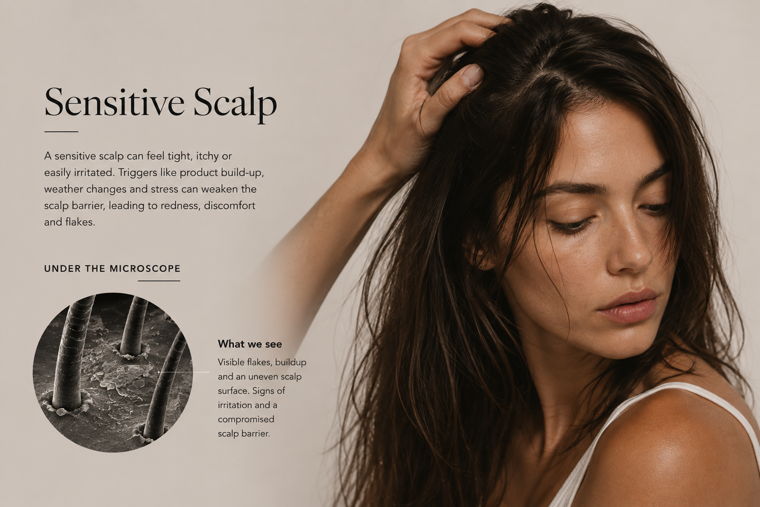 Sensitive Scalp